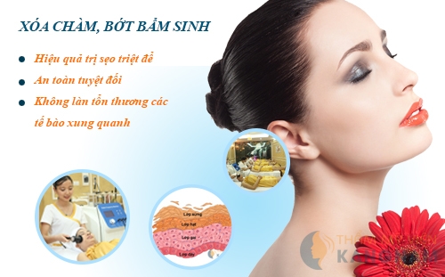 xoacham-dalieuhongduc